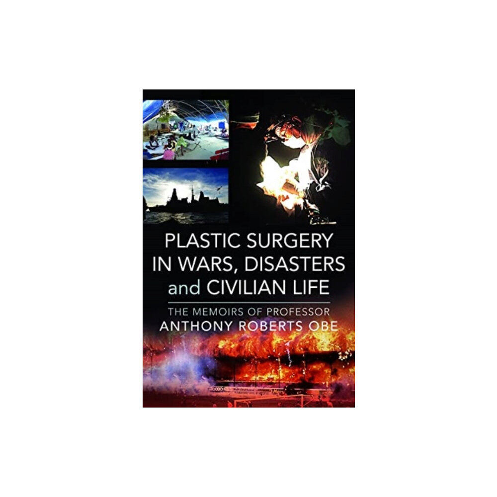 Pen & Sword Books Ltd Plastic Surgery in Wars, Disasters and Civilian Life (inbunden, eng)