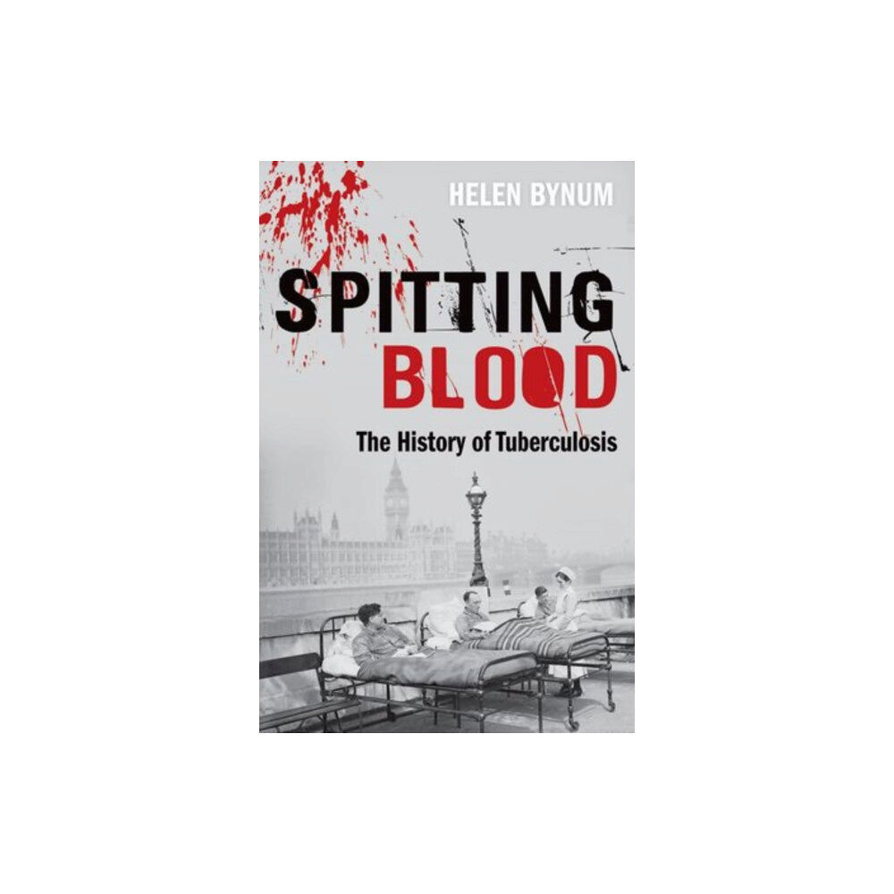 Oxford University Press Spitting Blood (häftad, eng)