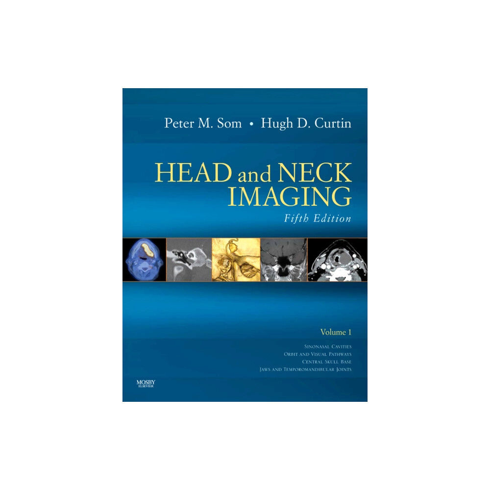 Elsevier - Health Sciences Division Head and Neck Imaging - 2 Volume Set (inbunden, eng)