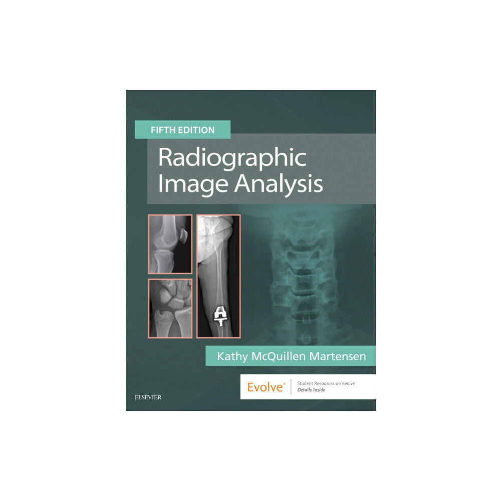 Elsevier - Health Sciences Division Radiographic Image Analysis (inbunden, eng)