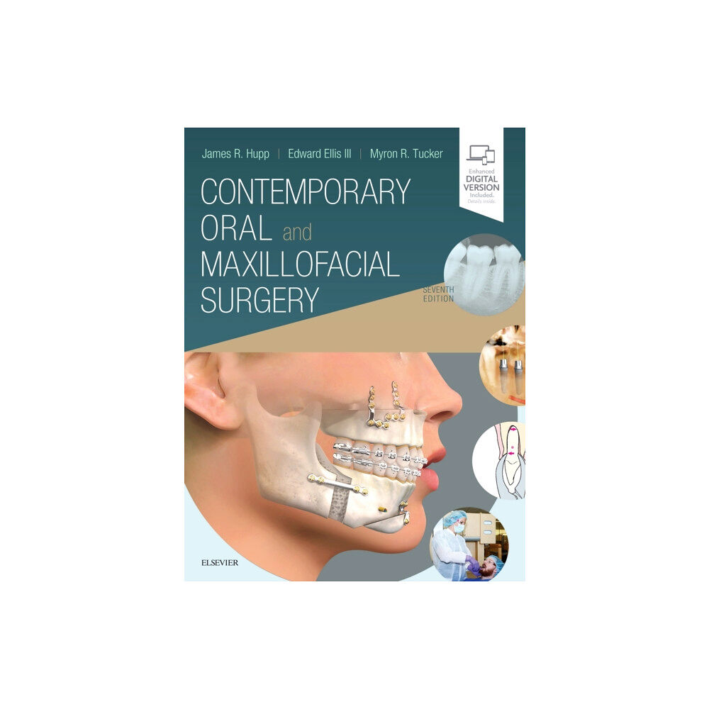 Elsevier - Health Sciences Division Contemporary Oral and Maxillofacial Surgery (inbunden, eng)