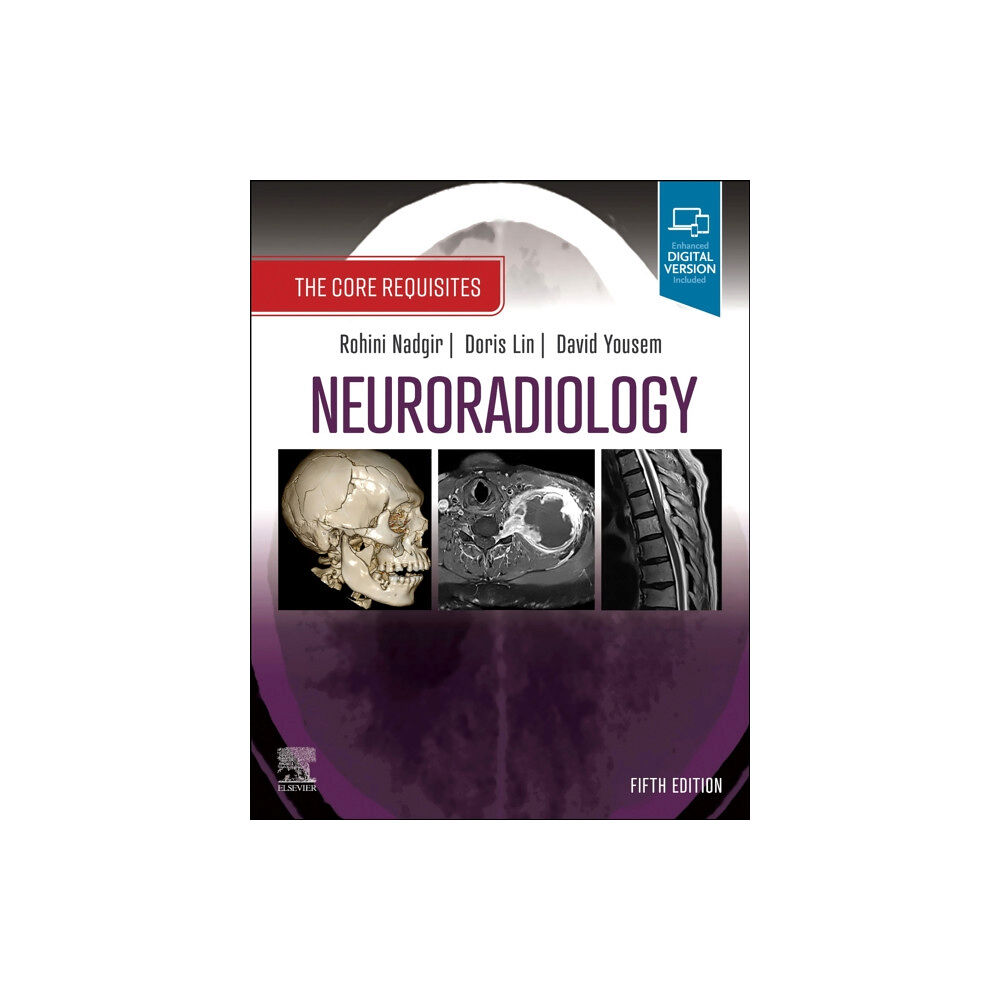 Elsevier - Health Sciences Division Neuroradiology (häftad, eng)