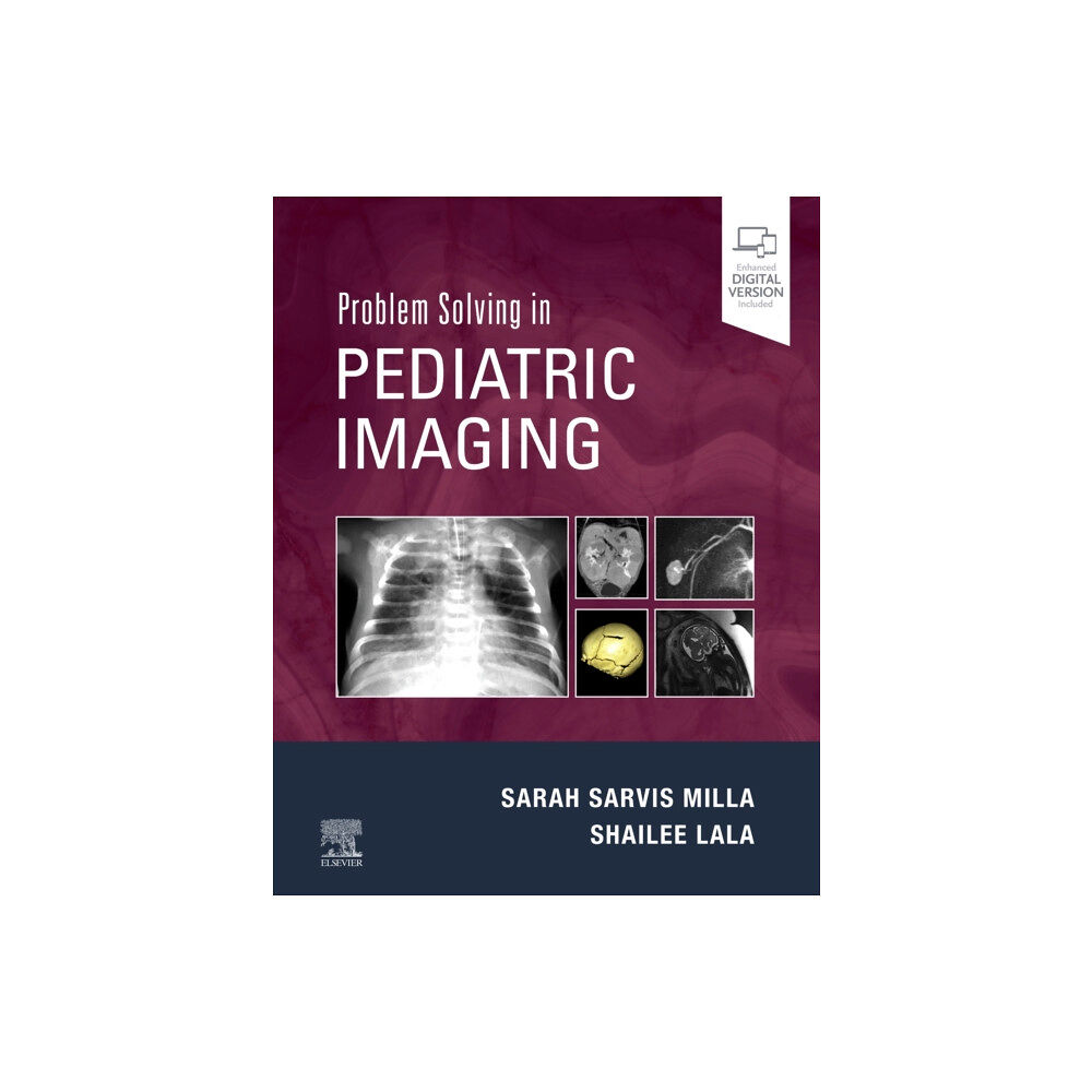 Elsevier - Health Sciences Division Problem Solving in Pediatric Imaging (inbunden, eng)