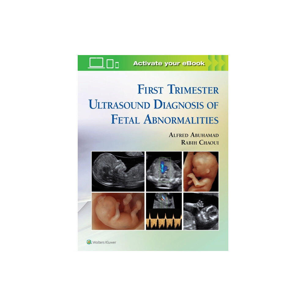 Lippincott Williams and Wilkins First Trimester Ultrasound Diagnosis of Fetal Abnormalities (inbunden, eng)