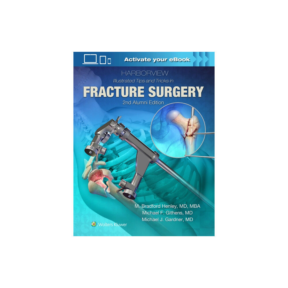 Lippincott Williams and Wilkins Harborview Illustrated Tips and Tricks in Fracture Surgery (inbunden, eng)