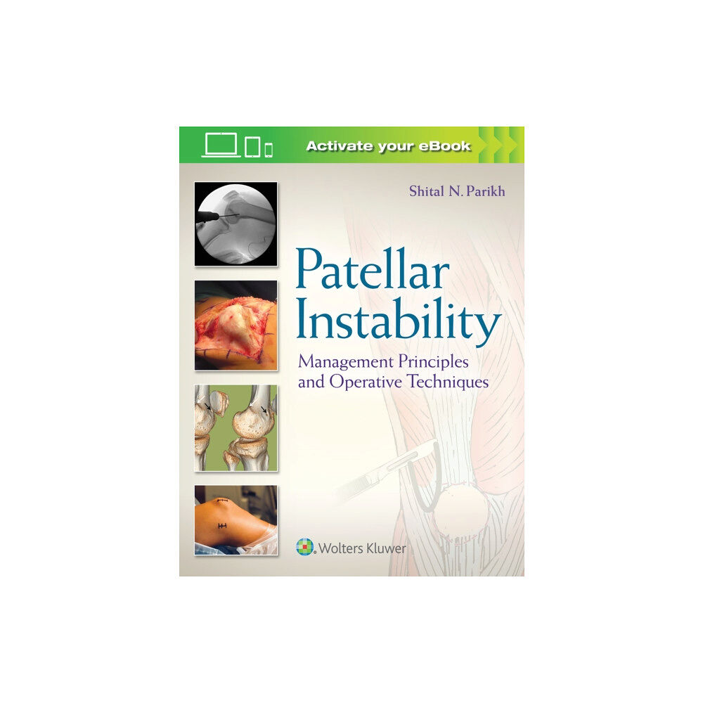 Lippincott Williams and Wilkins Patellar Instability (inbunden, eng)