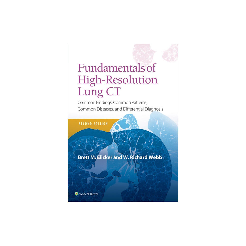 Lippincott Williams and Wilkins Fundamentals of High-Resolution Lung CT (häftad, eng)