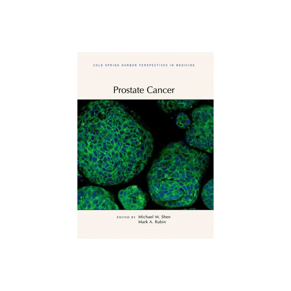 Cold Spring Harbor Laboratory Press,U.S. Prostate Cancer (inbunden, eng)