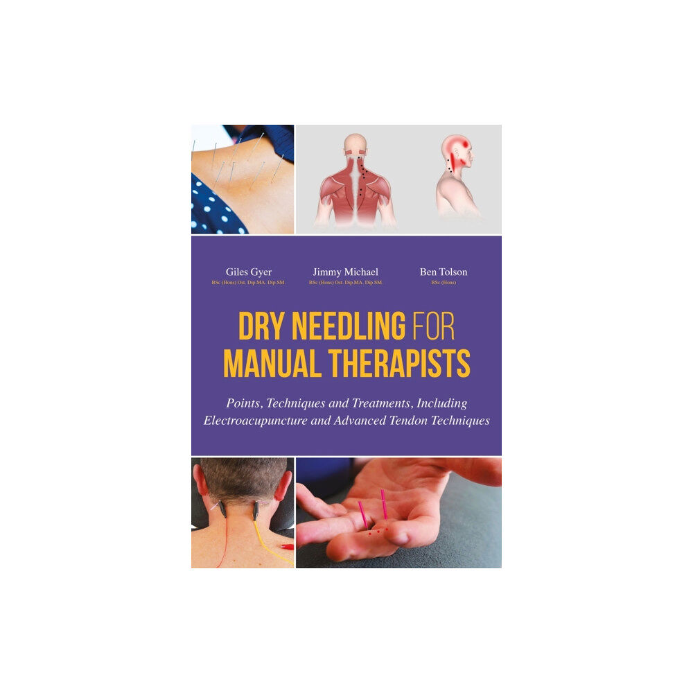 Jessica kingsley publishers Dry Needling for Manual Therapists (inbunden, eng)