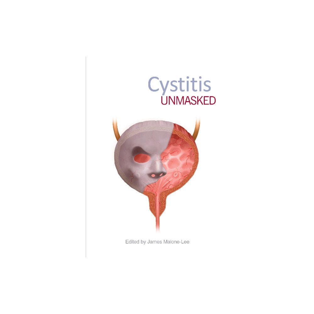 TFM Publishing Ltd Cystitis Unmasked (häftad, eng)