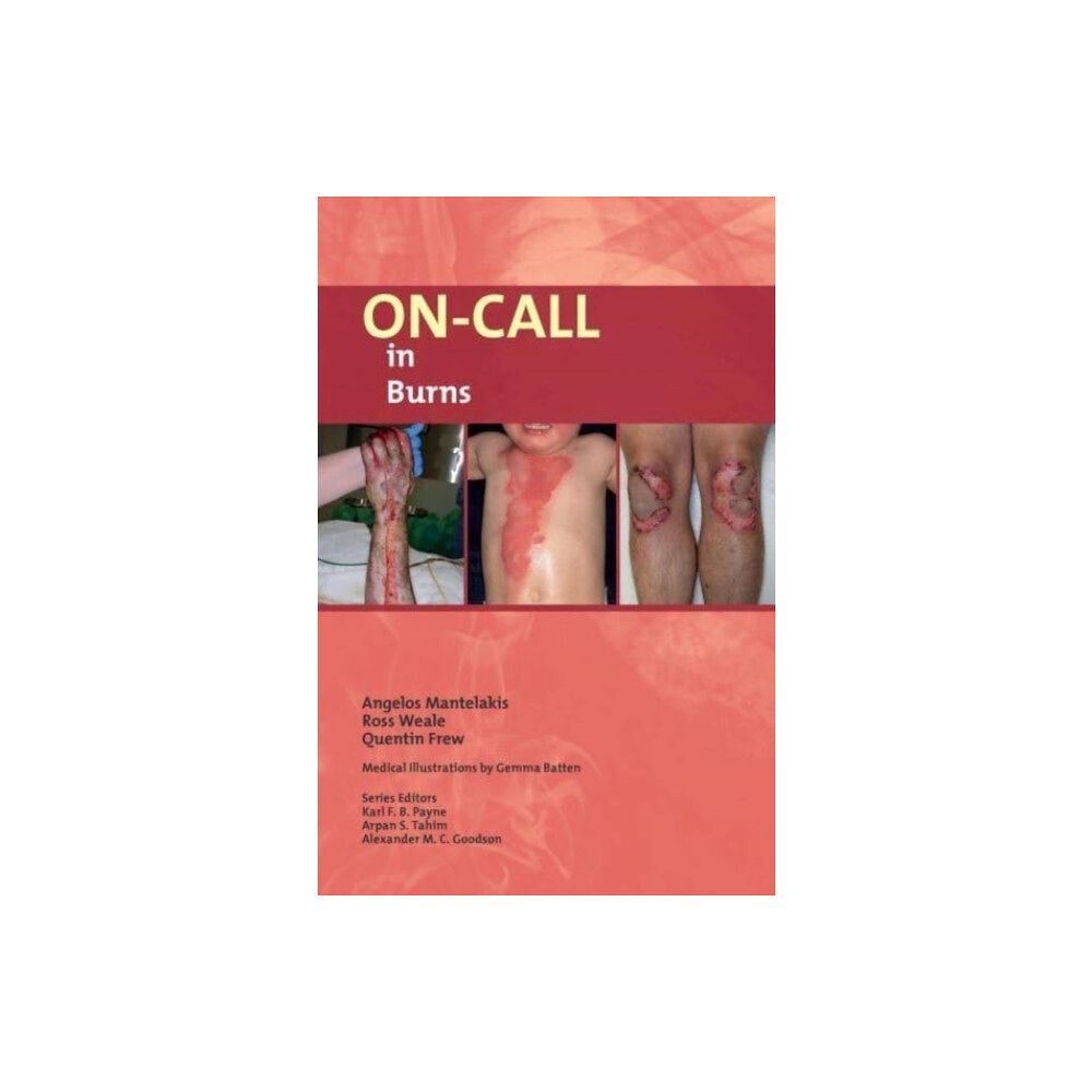 Libri Publishing On-Call in Burns (häftad, eng)