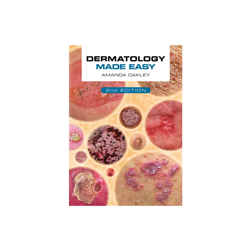 Scion Publishing Ltd Dermatology Made Easy, second edition (häftad, eng)