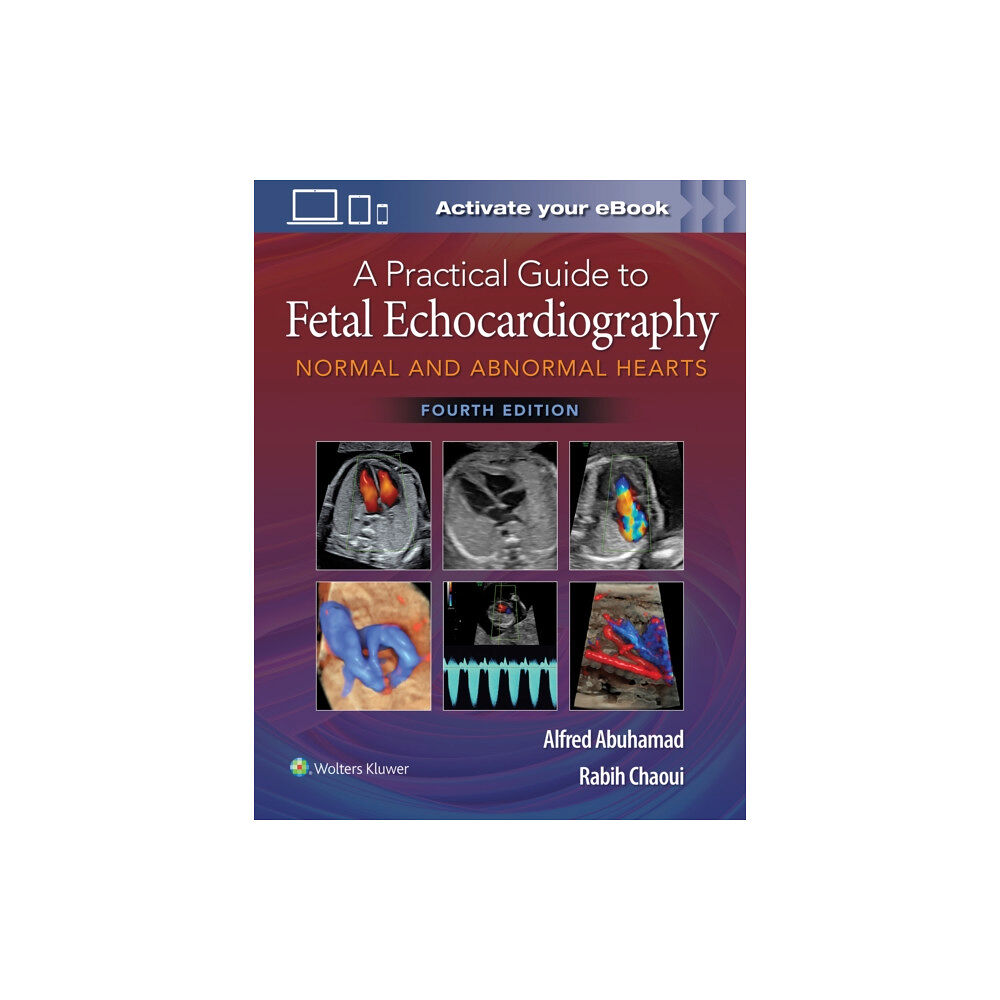 Wolters Kluwer Health A Practical Guide to Fetal Echocardiography (inbunden, eng)