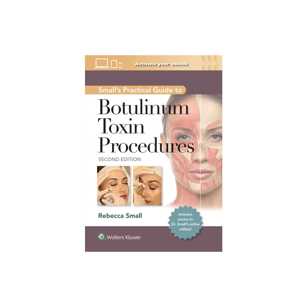 Wolters Kluwer Health Small's Practical Guide to Botulinum Toxin Procedures: Print + eBook with Multimedia (inbunden, eng)