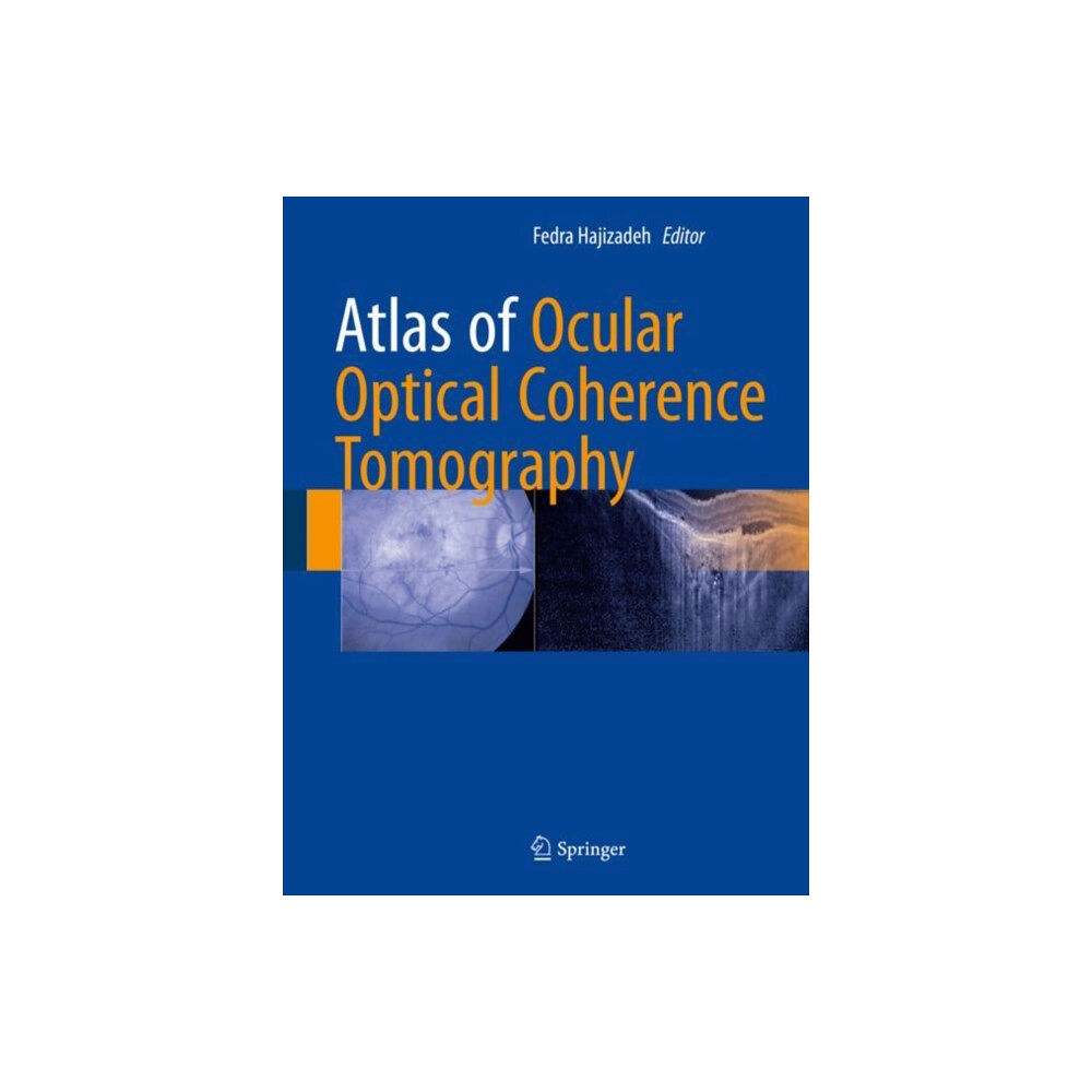 Springer International Publishing AG Atlas of Ocular Optical Coherence Tomography (inbunden, eng)