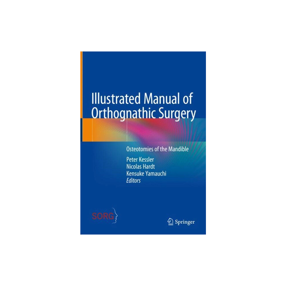 Springer International Publishing AG Illustrated Manual of Orthognathic Surgery (inbunden, eng)