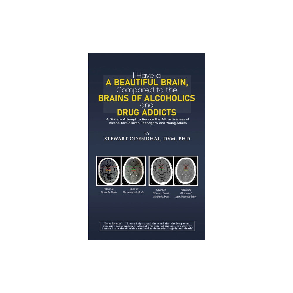 Austin Macauley Publishers LLC I Have a Beautiful Brain, Compared to the Brains of Alcoholics and Drug Addicts (häftad, eng)