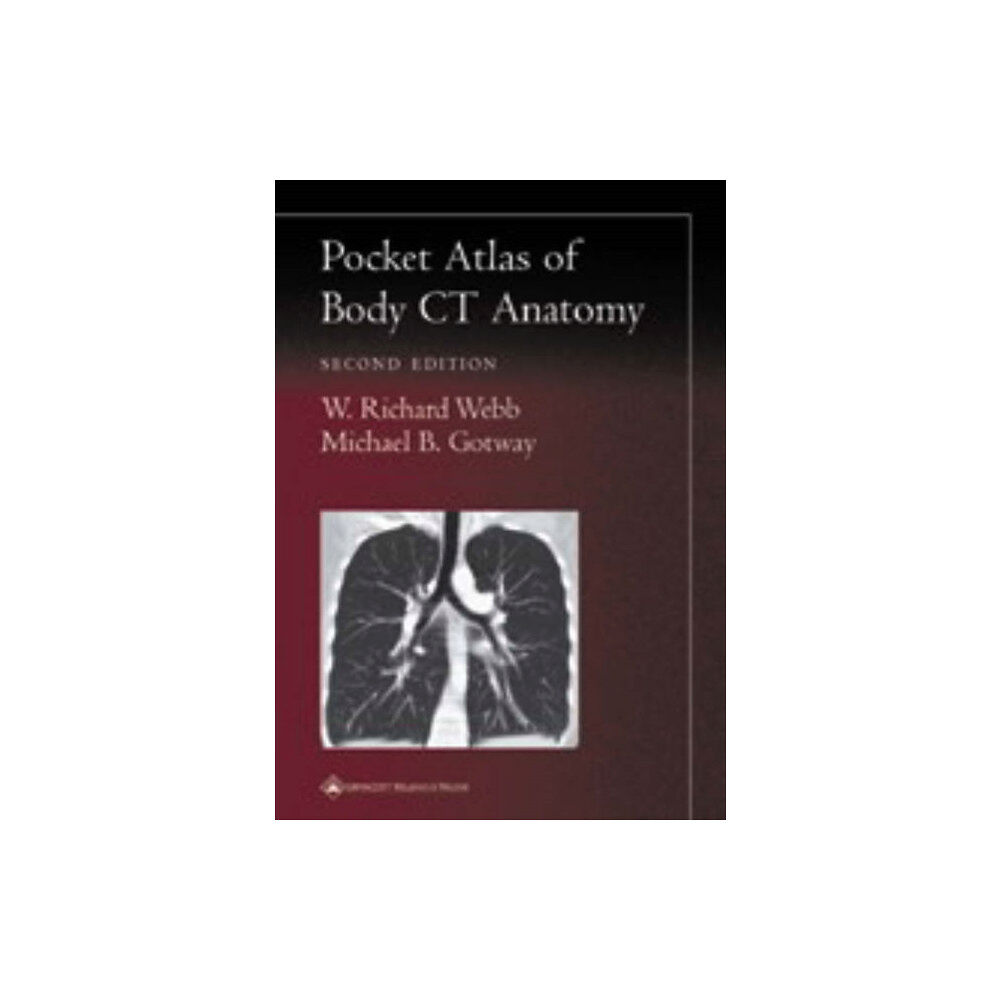 Lippincott Williams and Wilkins Pocket Atlas of Body CT Anatomy (häftad, eng)