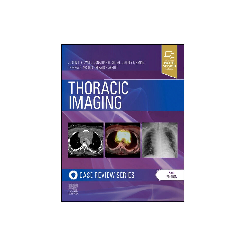 Elsevier - Health Sciences Division Thoracic Imaging: Case Review (häftad, eng)