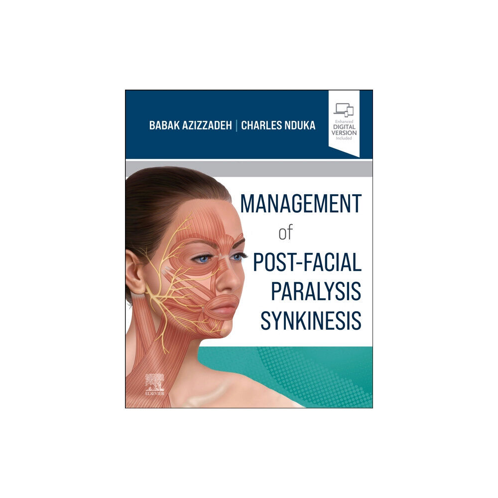 Elsevier - Health Sciences Division Management of Post-Facial Paralysis Synkinesis (inbunden, eng)