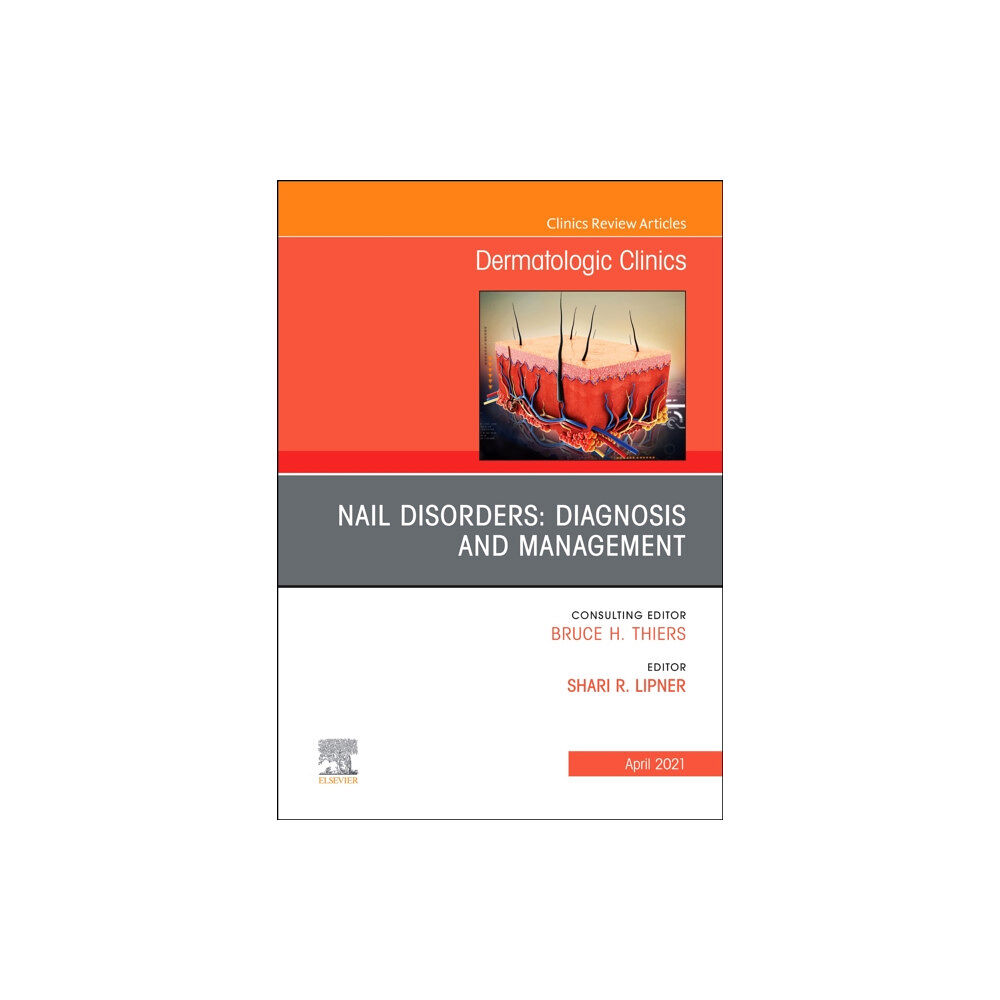 Elsevier - Health Sciences Division Nail Disorders: Diagnosis and Management, An Issue of Dermatologic Clinics (inbunden, eng)