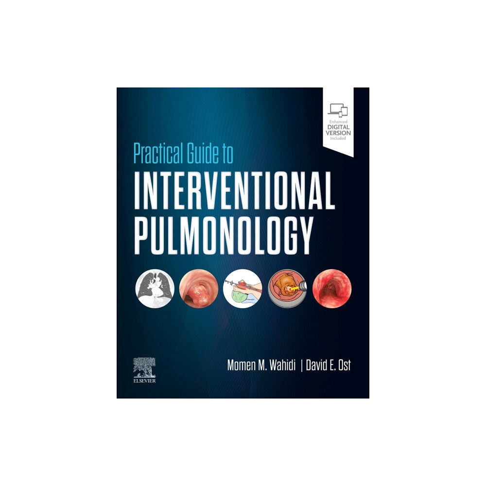 Elsevier - Health Sciences Division Practical Guide to Interventional Pulmonology (inbunden, eng)