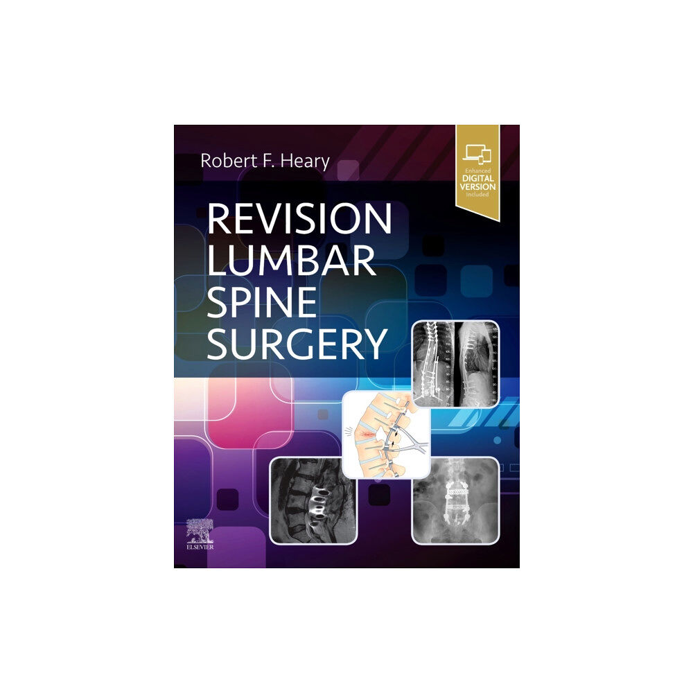 Elsevier - Health Sciences Division Revision Lumbar Spine Surgery (inbunden, eng)