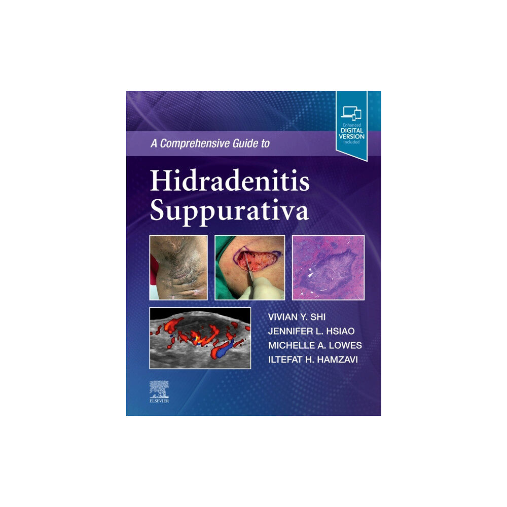 Elsevier - Health Sciences Division A Comprehensive Guide to Hidradenitis Suppurativa (inbunden, eng)