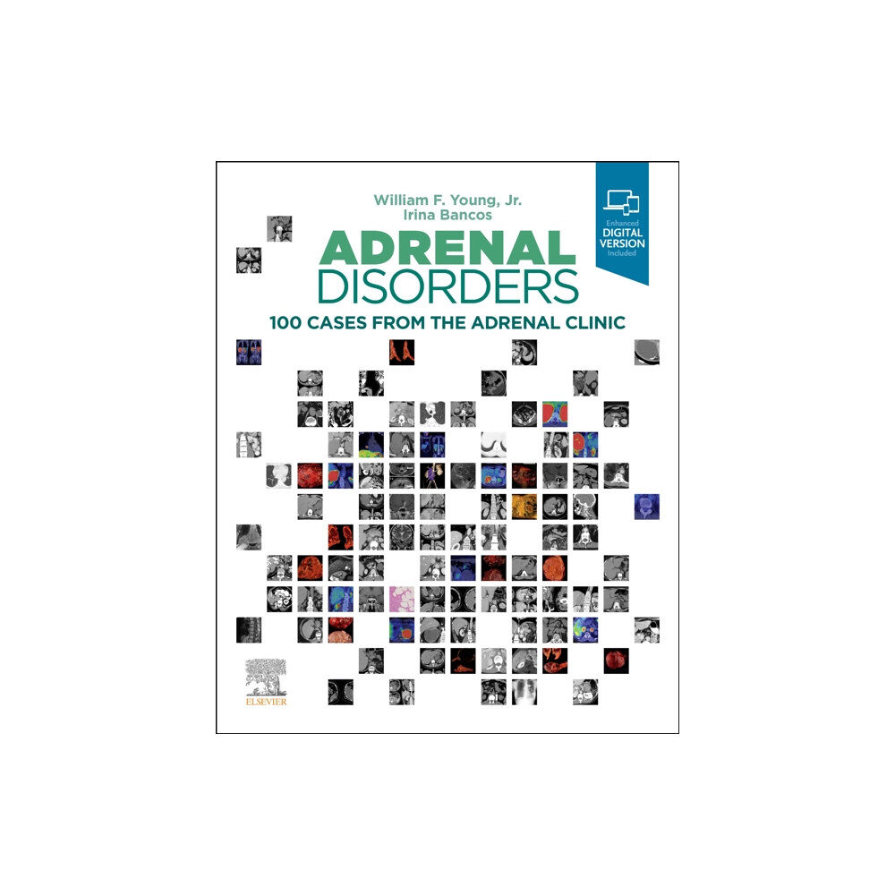 Elsevier - Health Sciences Division Adrenal Disorders (inbunden, eng)