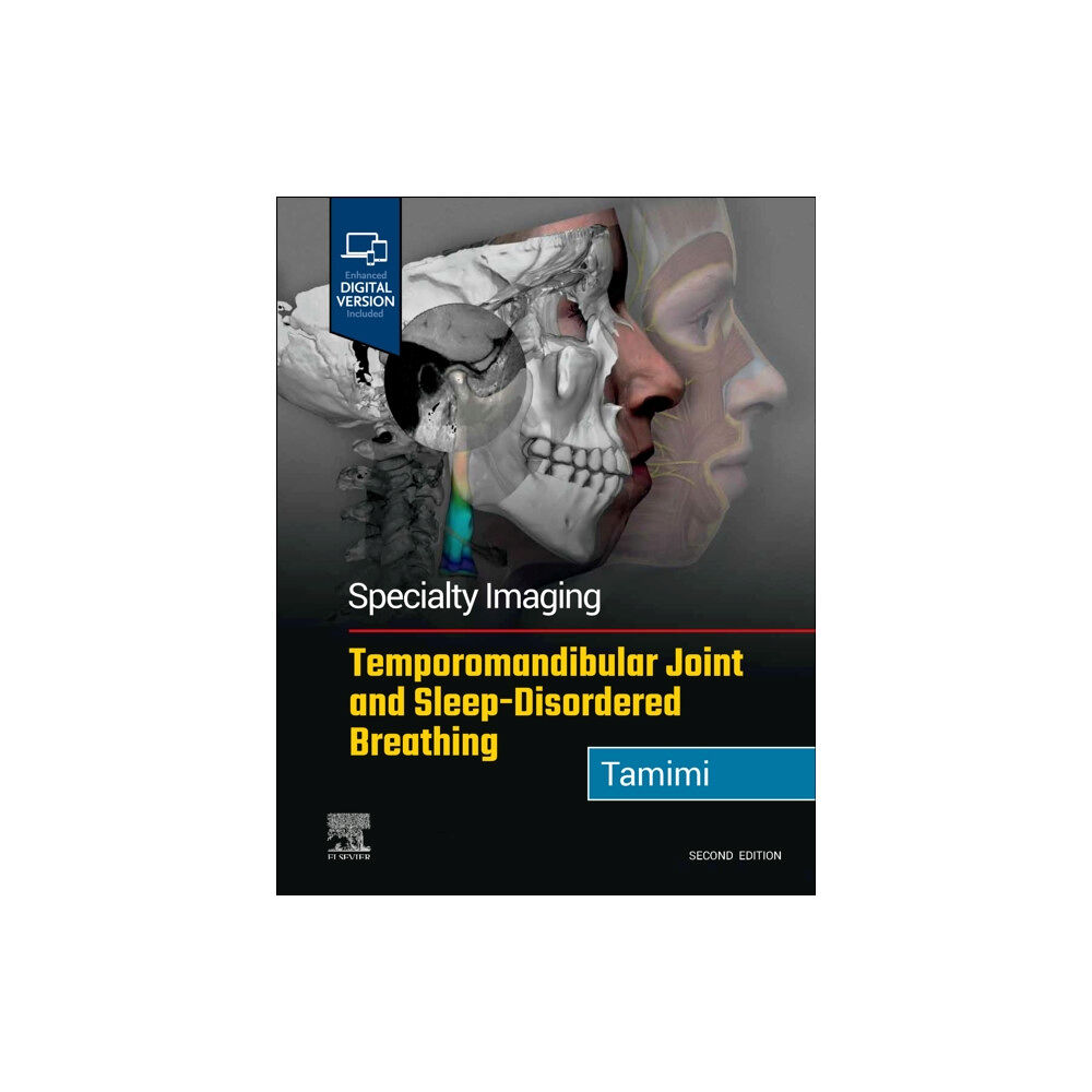 Elsevier - Health Sciences Division Specialty Imaging: Temporomandibular Joint and Sleep-Disordered Breathing (inbunden, eng)