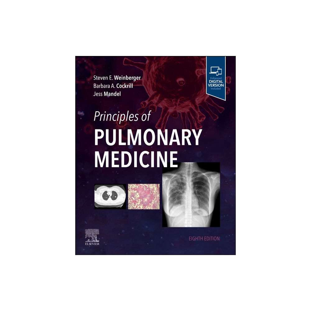 Elsevier - Health Sciences Division Principles of Pulmonary Medicine (häftad, eng)