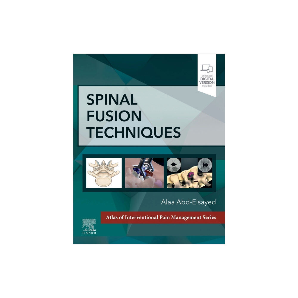 Elsevier - Health Sciences Division Spinal Fusion Techniques (inbunden, eng)