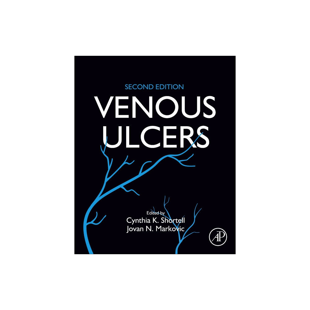 Elsevier Science & Technology Venous Ulcers (häftad, eng)