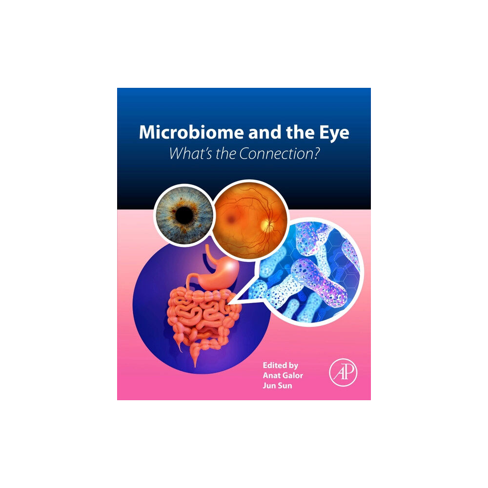 Elsevier Science & Technology Microbiome and the Eye (häftad, eng)