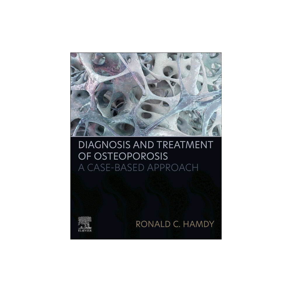 Elsevier - Health Sciences Division Diagnosis and Treatment of Osteoporosis (häftad, eng)