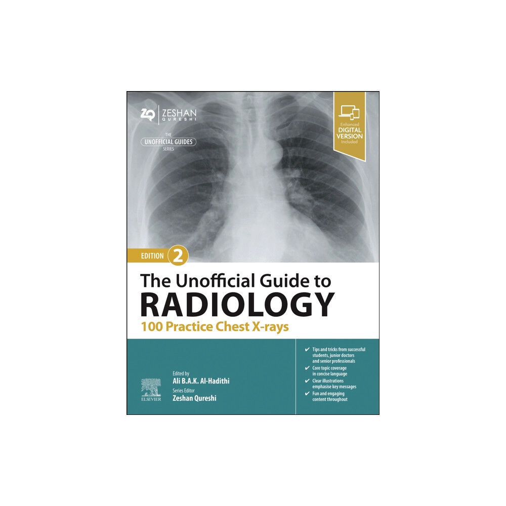 Elsevier Health Sciences The Unofficial Guide to Radiology: 100 Practice Chest X-rays (häftad, eng)