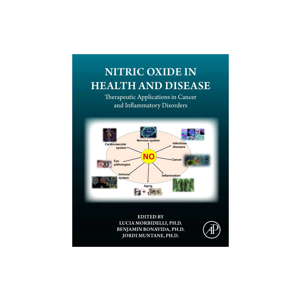 Elsevier Science Publishing Co Inc Nitric Oxide in Health and Disease (häftad, eng)