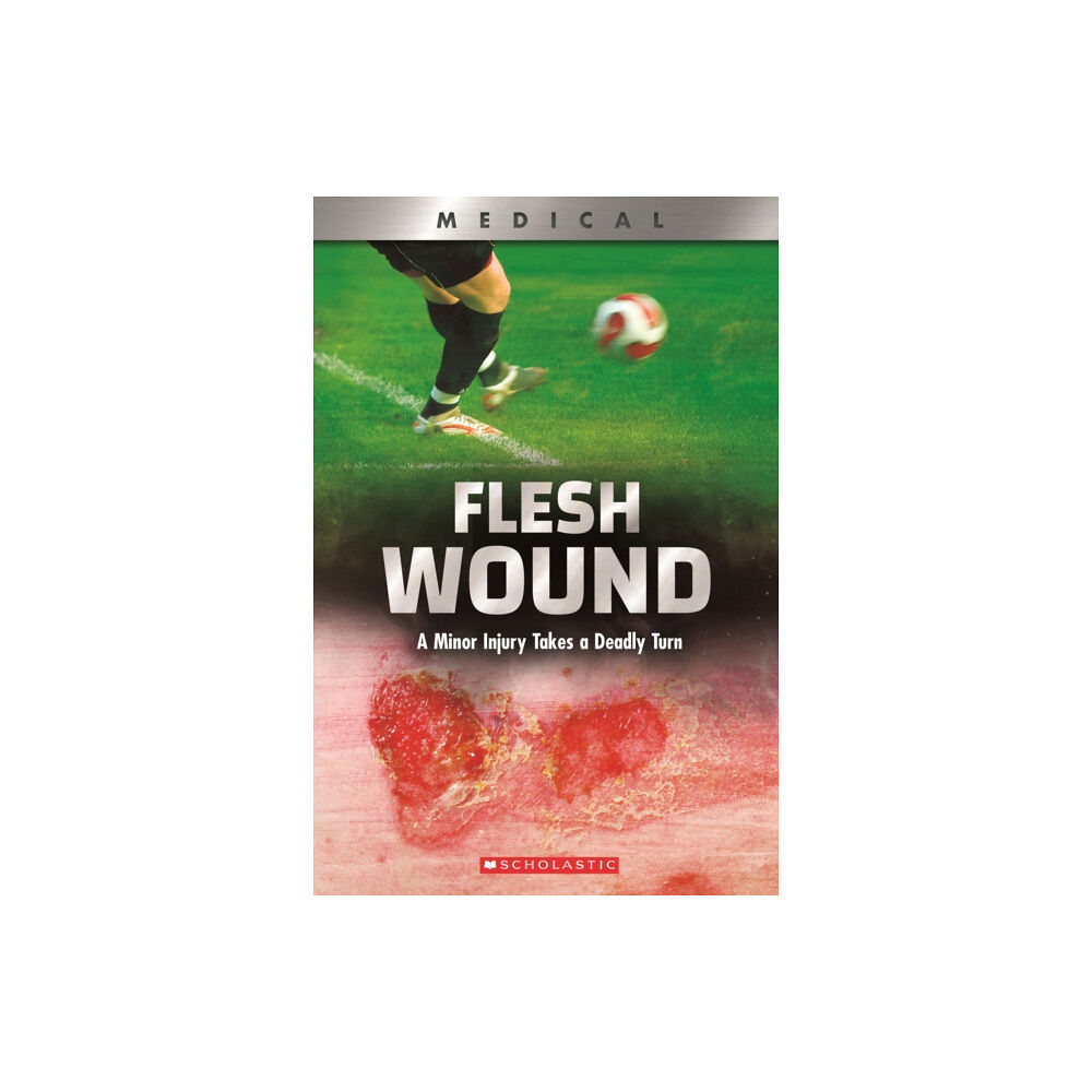 Scholastic Inc. Flesh Wound: A Minor Injury Takes a Deadly Turn (XBooks) (häftad, eng)