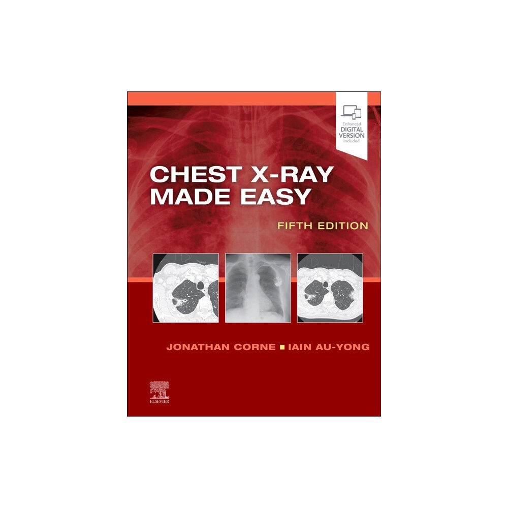 Elsevier Health Sciences Chest X-Ray Made Easy (häftad, eng)