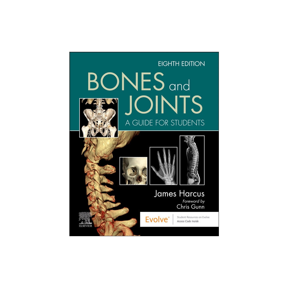 Elsevier Health Sciences Bones and Joints (häftad, eng)