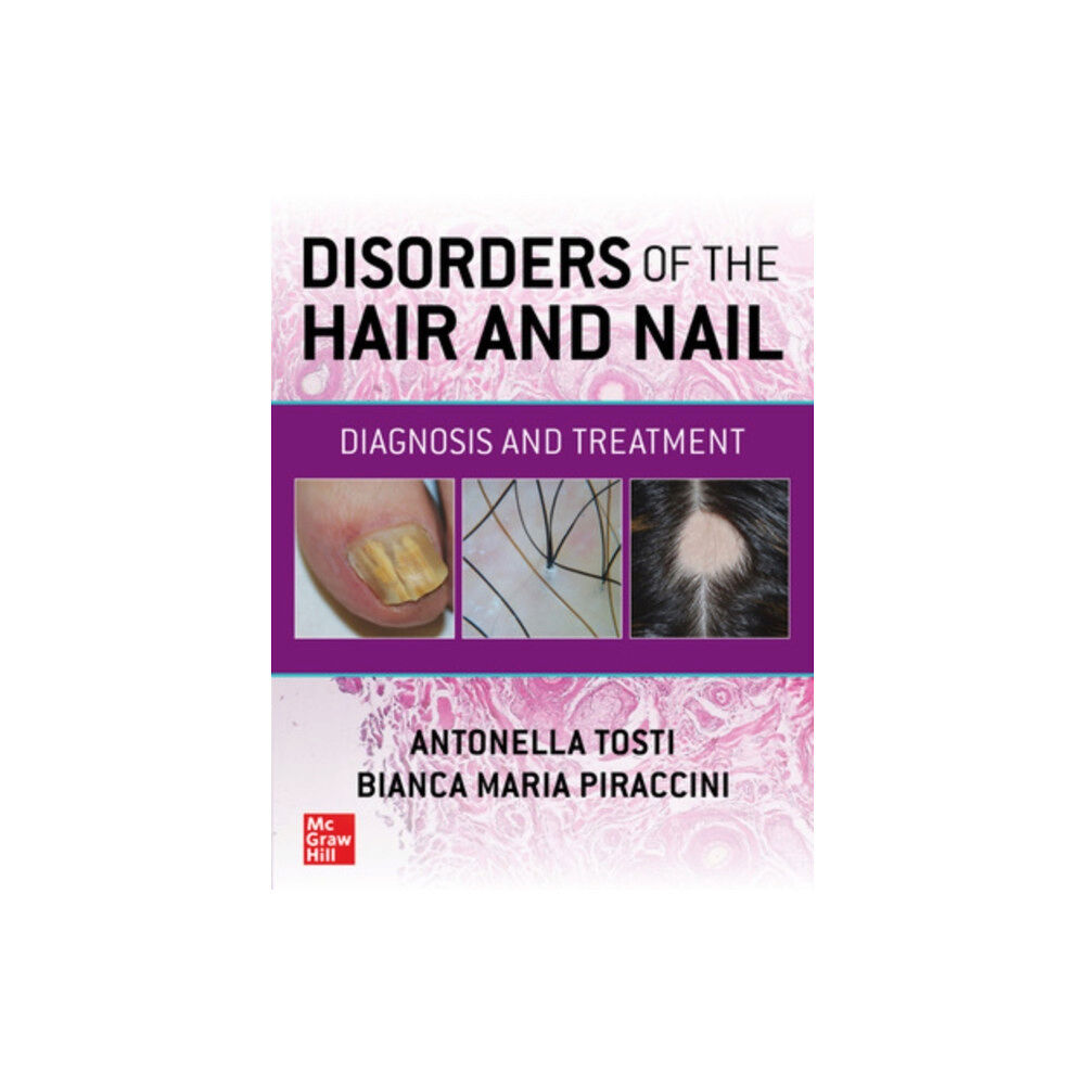 McGraw-Hill Education Disorders of the Hair and Nail: Diagnosis and Treatment (häftad, eng)