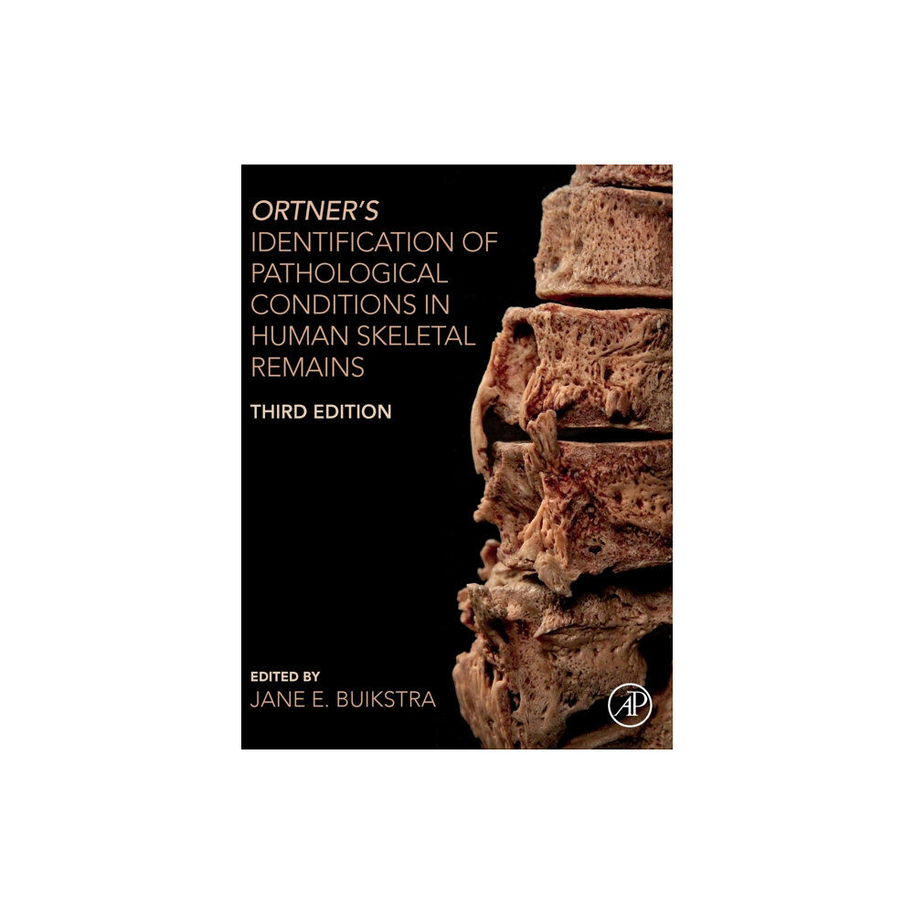 Elsevier Science Publishing Co Inc Ortner's Identification of Pathological Conditions in Human Skeletal Remains (inbunden, eng)