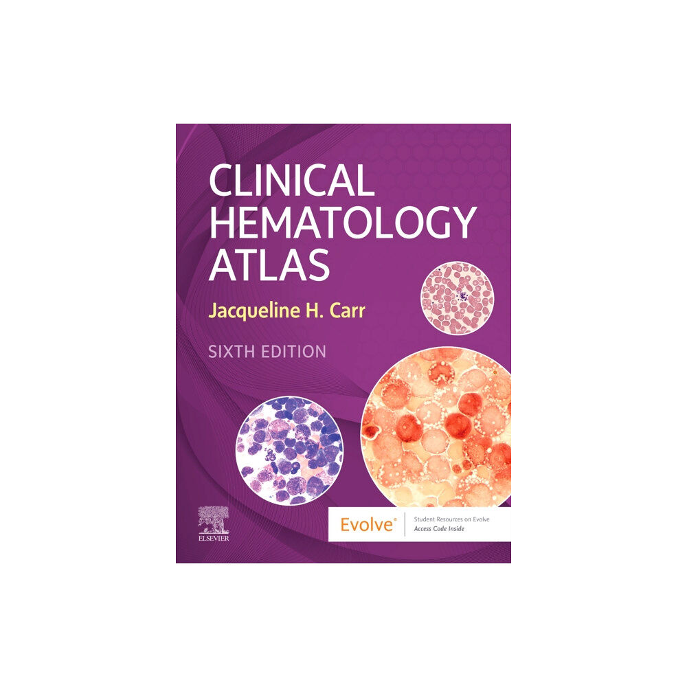 Elsevier - Health Sciences Division Clinical Hematology Atlas (bok, spiral, eng)