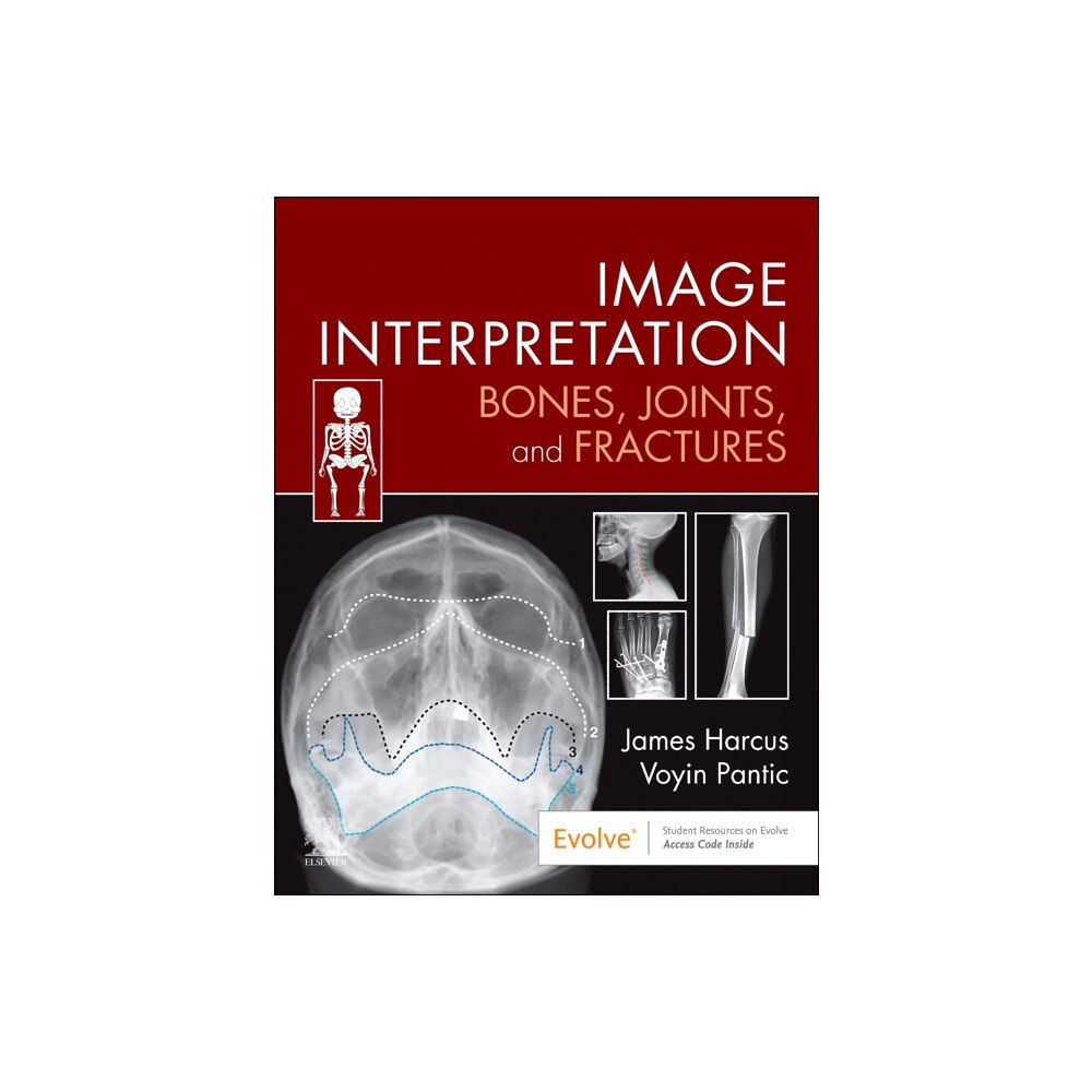 Elsevier - Health Sciences Division Image Interpretation: Bones, Joints, and Fractures (häftad, eng)