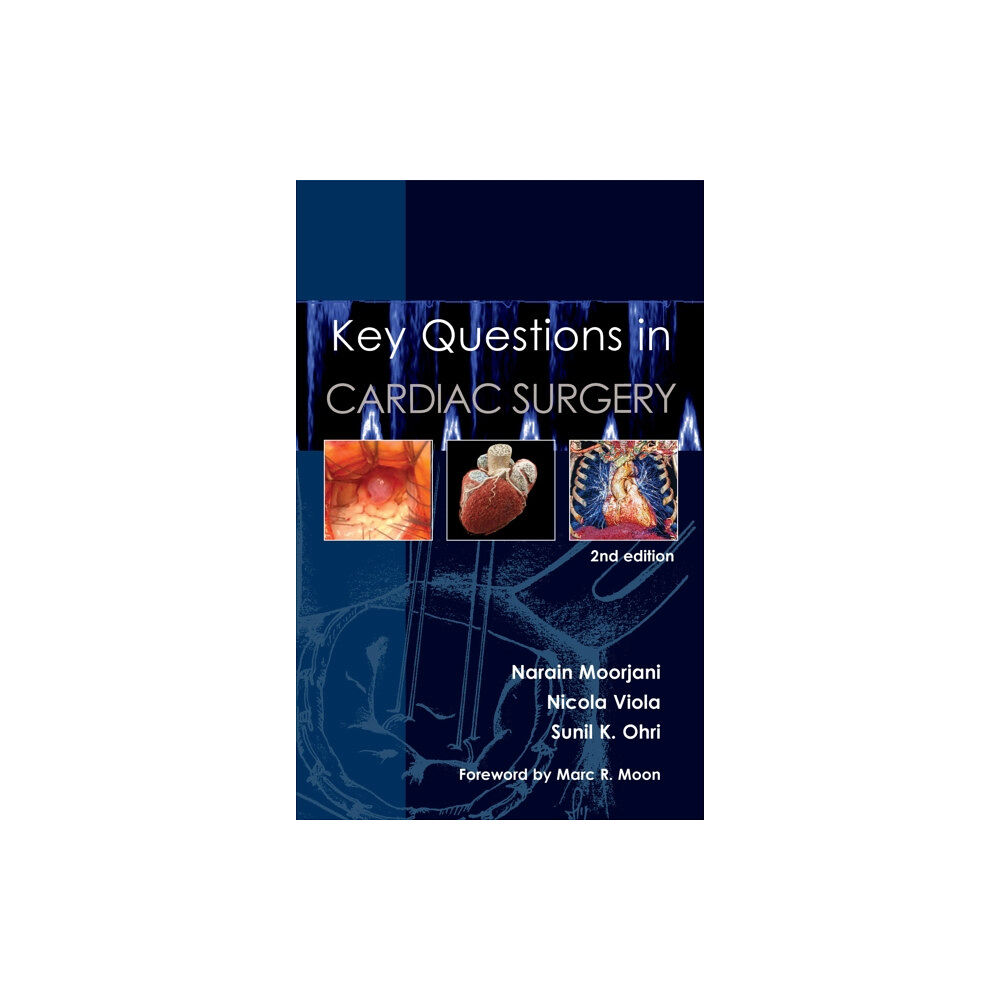 TFM Publishing Ltd Key Questions in Cardiac Surgery (häftad, eng)