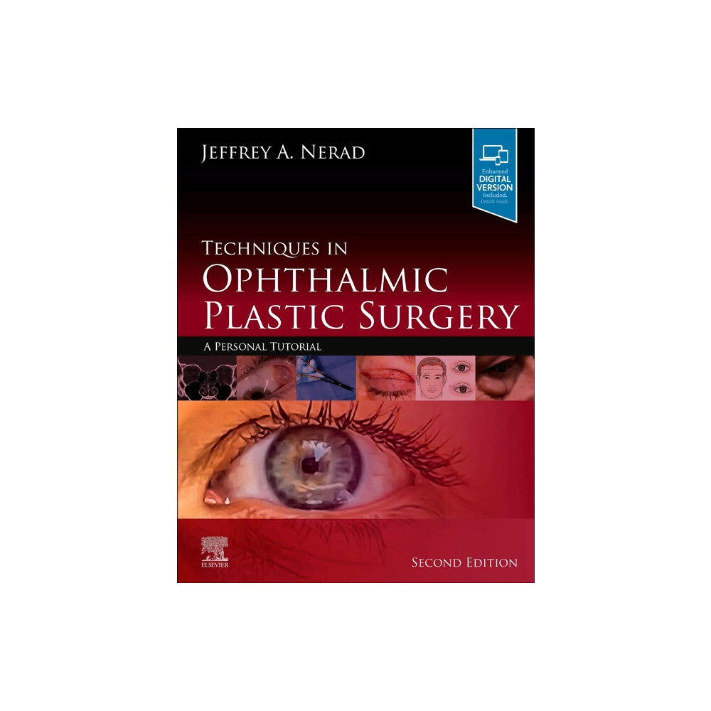 Elsevier - Health Sciences Division Techniques in Ophthalmic Plastic Surgery (inbunden, eng)