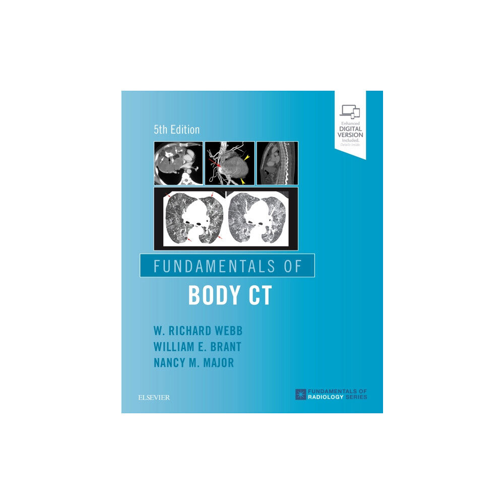 Elsevier - Health Sciences Division Fundamentals of Body CT (häftad, eng)