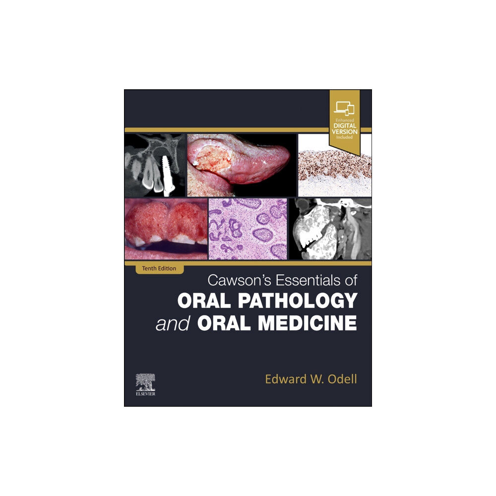 Elsevier - Health Sciences Division Cawson's Essentials of Oral Pathology and Oral Medicine (häftad, eng)