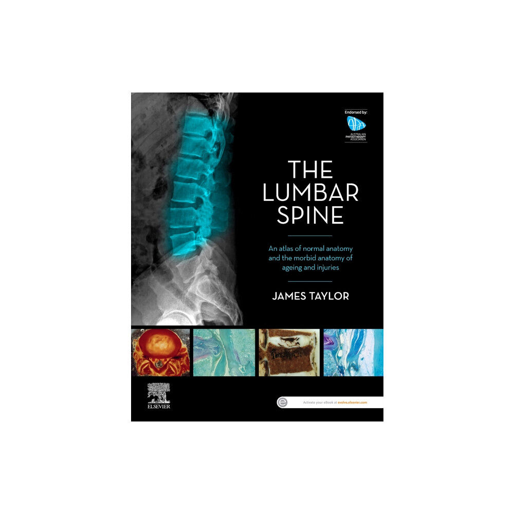 Elsevier Australia The Lumbar Spine (häftad, eng)