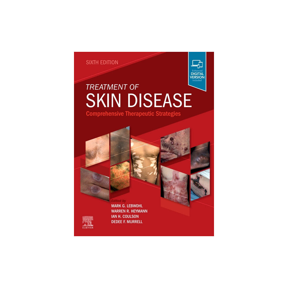 Elsevier Health Sciences Treatment of Skin Disease (inbunden, eng)